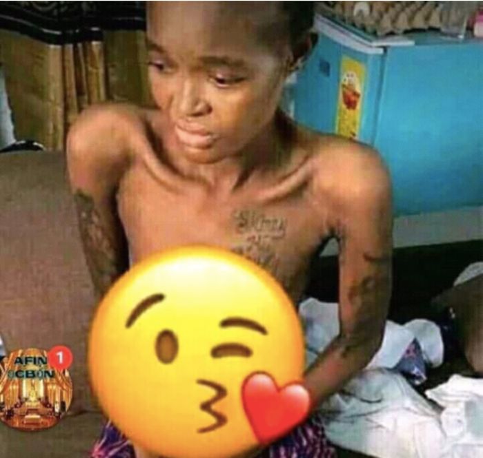 Slay Queen contracts HIV