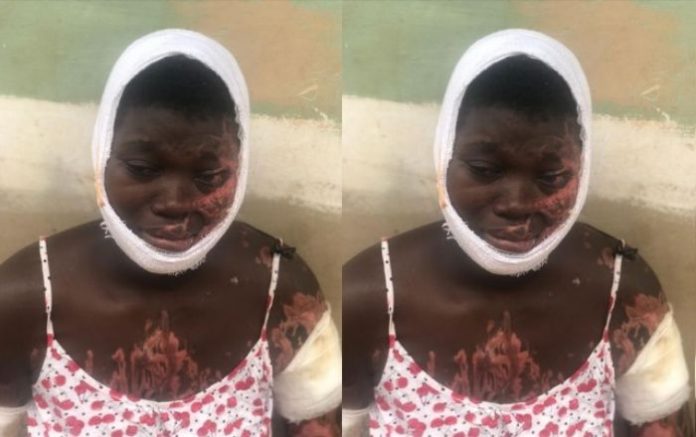 Jealous Boyfriend Sprays Lover With Acid For Allegedly Cheating On Him - Photos