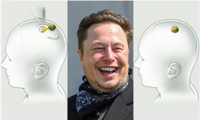 Elon Musk reveals microchips for human brains ready by 2022