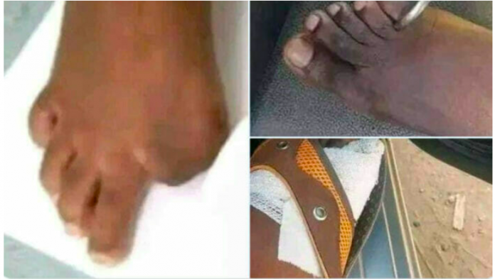 Selling toes in Zimbabwe
